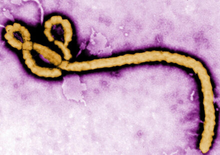 France's first detected Ebola patient recovers, leaves hospital