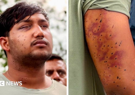 CJP protest: India's 'Cockroach' protesters have wounds consistent with pellet-gun fire, experts say