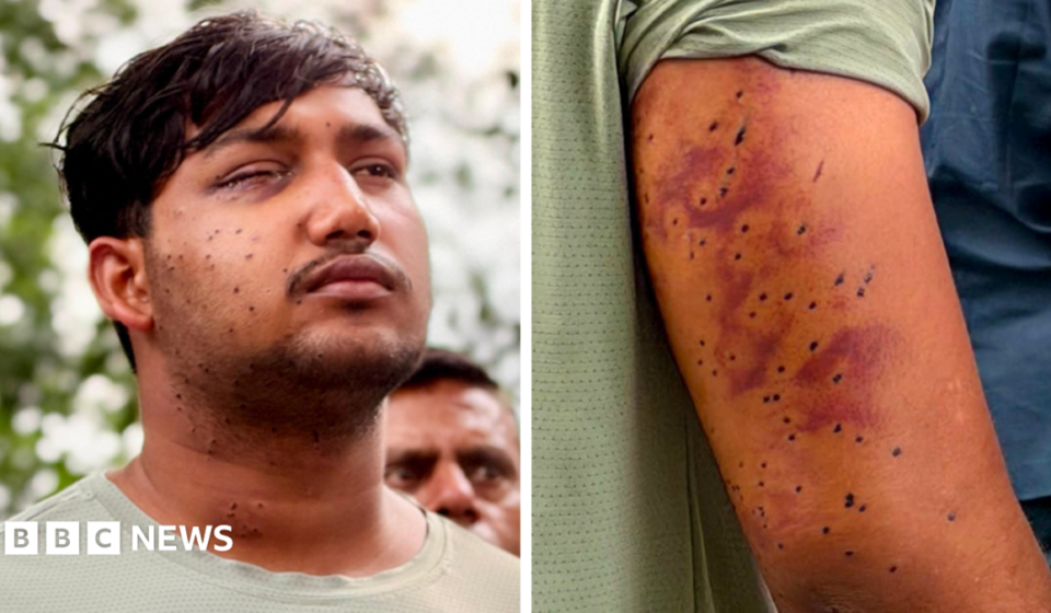 CJP protest: India's 'Cockroach' protesters have wounds consistent with pellet-gun fire, experts say