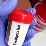 Cyclospora outbreak: First two deaths reported in Michigan
