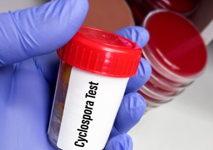Cyclospora outbreak: First two deaths reported in Michigan