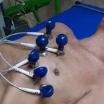 Huelga de hambre: Opositor sufre emergencia cardíaca tras 72 días en huelga de hambre