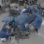 Moment earthquake shakes hospital operating room in Japan