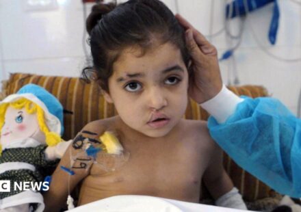 Girl has multiple surgeries to control infections after strike in Gaza