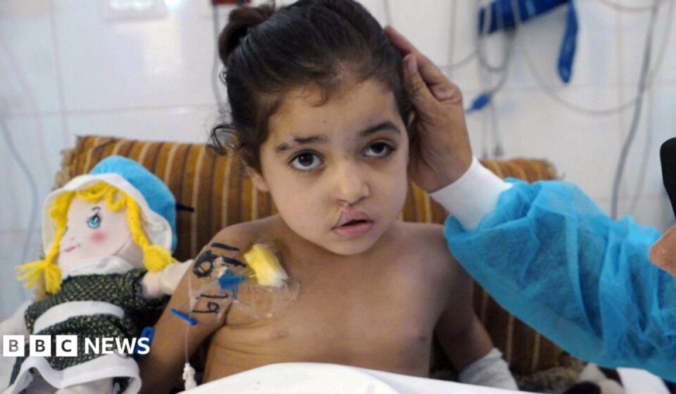 Girl has multiple surgeries to control infections after strike in Gaza