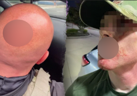 ICE officer assaults surge 1,649% since Trump crackdown, DHS says