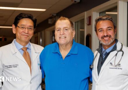 Pig kidney works in human body for 271 days - is this the future of organ transplants?