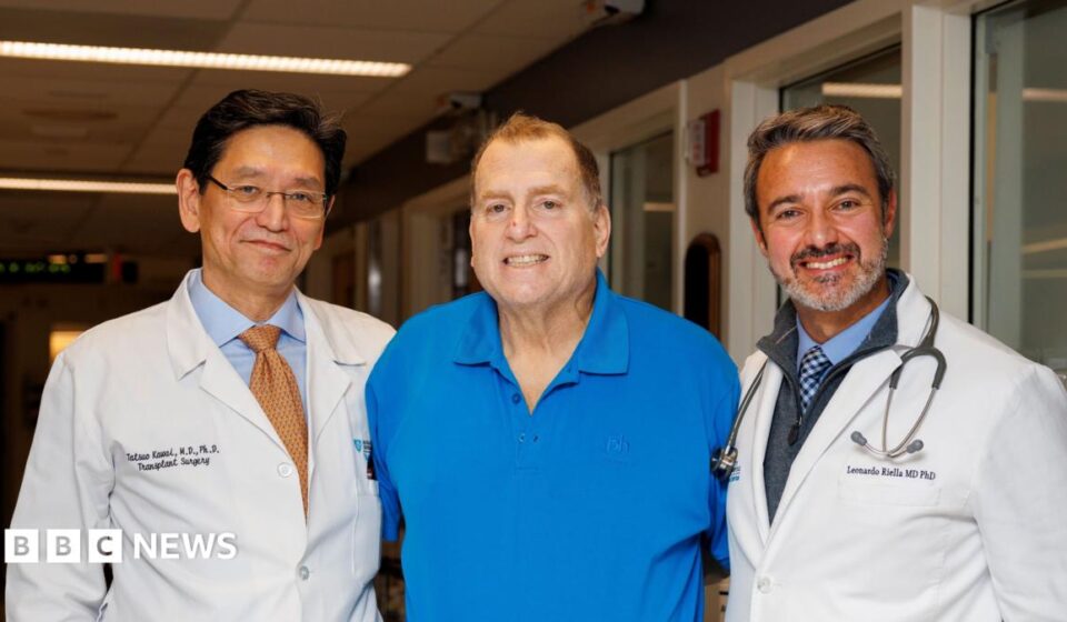 Pig kidney works in human body for 271 days - is this the future of organ transplants?