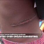 Shady surgeons and Nigeria organ harvesting - Eye on Africa