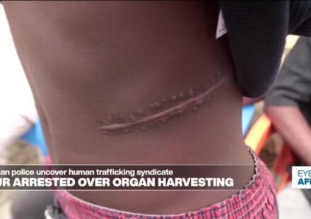 Shady surgeons and Nigeria organ harvesting - Eye on Africa