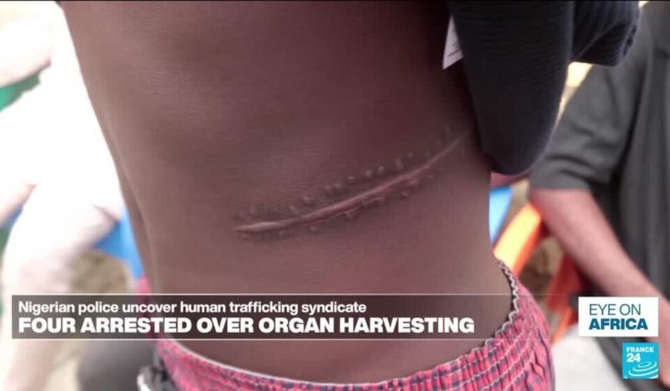 Shady surgeons and Nigeria organ harvesting - Eye on Africa