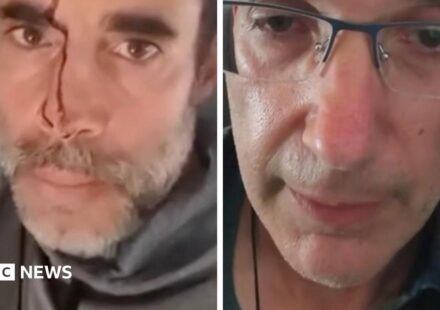 Watch: Passengers describe stabbing on Israel-bound plane