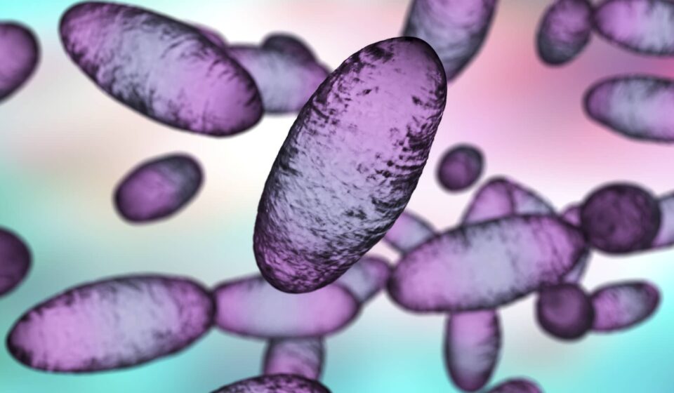 Russian lab worker dies amid plague reports — here's what we know