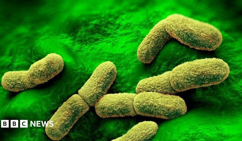 US 'watching closely' after plague researcher dies in Russia